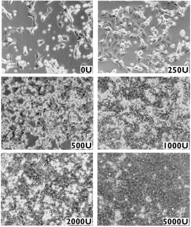 Cytopathic effect in severe acute respiratory syndrome-related coronavirus (SARS CoV)-infected Vero E6 cells. Vero E6 cells were infected with the SARS CoV at an MOI of 0.001 for 1 h and then were incubated in Dulbecco's modified Eagle's medium containing the indicated amounts of interferon-α-2b (IU/mL). Cells were fixed with 4% formalin on day 3 after infection.