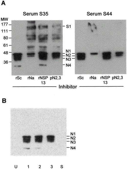 Demonstration that nucleocapsid (N) 1-N4 are all N antigens. A, Western blotting (WB) of 2 serum samples from patients with severe acute respiratory syndrome (SARS) (nos. S35 and S44) against the crude viral extract in the presence of various antigens used as inhibitor. B, WB of serum samples obtained from 3 mice immunized with recombinant N (rNa)-GST (lanes 1, 2, and 3) or from a representative mouse immunized with recombinant spike (rSa)-GST or recombinant spike (rSc)-GST (lane S), against the crude viral extract. MW, molecular weight (in kDa); pN2,3, gel-purified native N2 and N3 antigens; rNSP, recombinant nonstructural protein; U, unimmunized mouse.