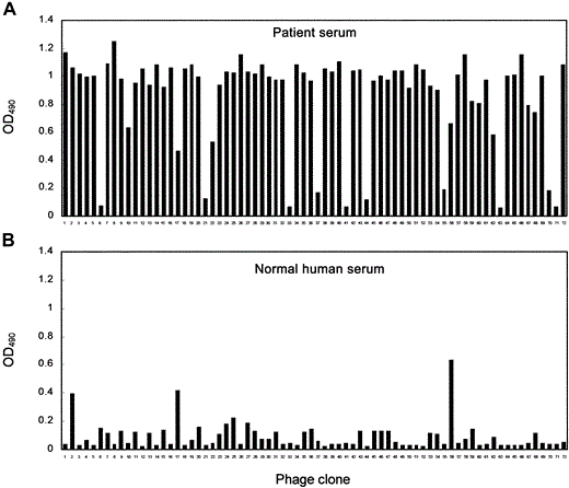 Identification of serum antibody-selected phage clones, by ELISA, in serum samples from a patient with severe acute respiratory syndrome (SP1). A phage-displayed random peptide library was screened with serum antibodies from patient SP1. After 3 screening rounds, 49 phage clones from 72 selected phage clones were significantly reactive to antibodies in serum samples from patient SP1 (A) but not to samples of normal human serum (B). OD490 , optical density at 490 nm.