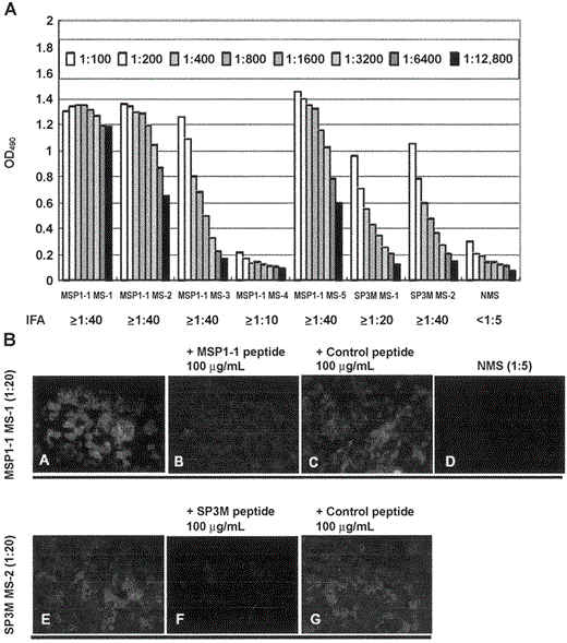 Phage-displayed epitopes immunogenic to severe acute respiratory syndrome-associated coronavirus (SARS-CoV). Vero E6 cells were infected with SARS-CoV and immunostained with antibodies against epitope-based synthetic peptides. Reactivity between peptide antigens and SARSCoV in serum samples from 5 mice immunized with peptide MSP1-1 (MSP1-1 MS-1-5) and 2 mice immunized with peptide SP3M (SP3M MS-1 and -2) was assayed by ELISA (A) and indirect fluorescent antibody (IFA) assay (B). SARS-CoV-infected cells were detected in serum samples from MSP1- 1-immunized mouse MS-1 (B, top row, panel A) and SP3M-immunized mouse MS-2 (B, bottom row, panel E) (20-fold dilution). The reactivity of antibodies with SARS-CoV was inhibited by 100 mg/mL of peptides MSP1-1 (B, panel B) and SP3M (B, panel F); 100 mg/mL of control peptide P7MM1 had no effect (B, panels C and G). Normal mouse serum (NMS; 5-fold dilution; B, panel D) did not react with SARS-CoV-infected cells. OD490 , optical density at 490 nm.