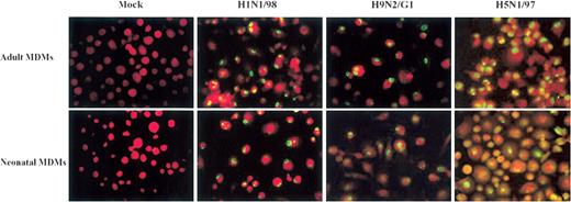 Immunofluorescence staining of viral nucleoprotein (NP) in influenza virus–infected adult and neonatal monocyte-derived macrophages (MDMs). Day-14 differentiated MDMs were infected by influenza viruses H1N1/98, H9N2/G1, and H5N1/97 at an MOI of 2. At the 12-h point of infection, cells were fixed and analyzed by immunofluorescent staining specific for influenza A virus matrix protein and NP (green) with Evan’s blue (red) as a counterstaining. More than 90% of cells were infected