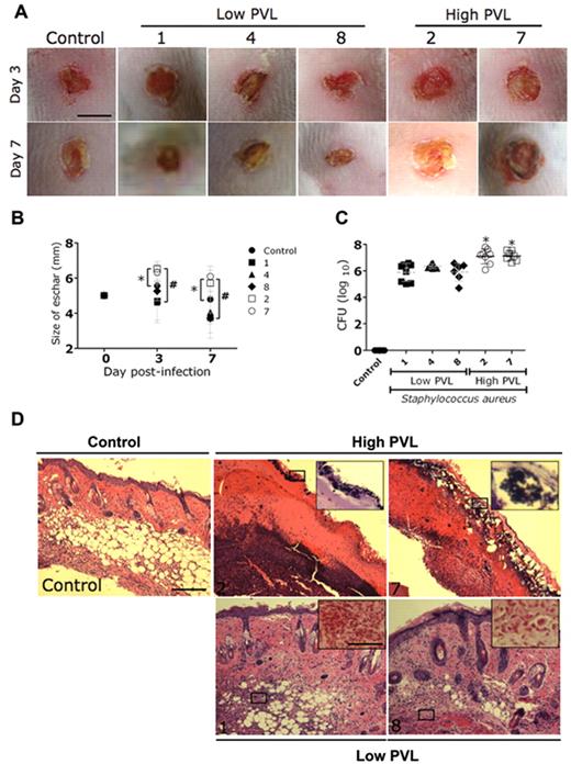 Comparison of virulence of Panton-Valentine leukocidin (PVL)-positive ...