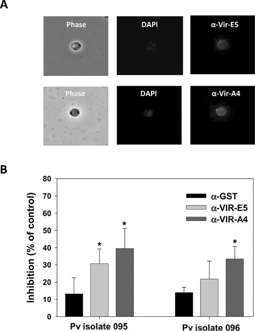 Recognition and blocking of Plasmodium vivax–infected erythrocyte (Pv-iE) cytoadhesion to human lung endothelial cells (HLECs) by specific VIR antisera. A, Immunofluorescence of a Pv-iE labeled with antisera against VIR-A4 (1:20) or VIR-E5 (1:20). Shown are results for phase contrast, 4′,6-diamidino-2-phenylindole dihydrochloride (DAPI) staining, and mouse anti–VIR-E5 (top) or anti–VIR-A4 (bottom) with Alexa Fluor 488–conjugated goat anti–mouse immunoglobulin G. B, Results of incubation of Pv-iEs ( 5 × 104 cells/well) for 1 h at 37°C alone or in the presence of VIR-A4 or VIR-E5 antisera diluted at 1:5 (isolate 095) or 1: 10 (isolate 096). In both assays, serum samples from mice immunized solely with glutathione S-transferase (GST) in Freund adjuvant were used as a negative control. For these assays, inhibition was determined as the percentage of negative control counts, expressed as mean values for triplicate wells; error bars indicate standard deviations. * P < .05 for the comparison of inhibition with GST antisera (Kruskal-Wallis test).