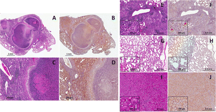 Postmortem histopathology and pimonidazole immunohistochemical analyses. Hematoxylin-eosin histology (A, C, E, G, I) and pimonidazole immunohistochemistry (B, D, F, H, J) were performed on lung sections from chronically infected C3HeB/FeJ mice 14 weeks after infection (A–D), BALB/c mice 8 weeks after infection (E, F), and uninfected C3HeB/FeJ mice (G, H) and on renal tubular cells in kidney tissues from C3HeB/FeJ mice (I, J). Pimonidazole staining is noted around the periphery of the necrotic granulomas (B, D). Although there is no evidence of necrosis, small foci of pimonidazole staining is observed in the chronically infected BALB/c mice (F,inset). No pimonidazole staining is observed in the uninfected C3HeB/FeJ mice (H), whereas significant pimonidazole staining is noted in the renal tubular cells in the kidney tissues (J).