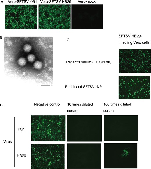 Reactivity of patient sera samples to severe fever with thrombocytopenia syndrome virus (SFTSV). A, Detection of SFTSV antigen in Vero cells by indirect immunofluorescence assay (IFA) with rabbit anti-SFTSV recombinant nucleoprotein (rNP) serum. B, Virions in the culture supernatant detected by electron microscopy (bar in the image indicates the length of 100 nm, ID: SPL004). C, Positive indirect IFA results of the serum collected from a surviving patient (ID: SPL030) in the convalescent phase of SFTSV HB29. D, Neutralizing antibody activity was induced in the serum collected from a patient (ID: SPL032) in the convalescent phase of SFTSV YG1 and SFTSV HB29.