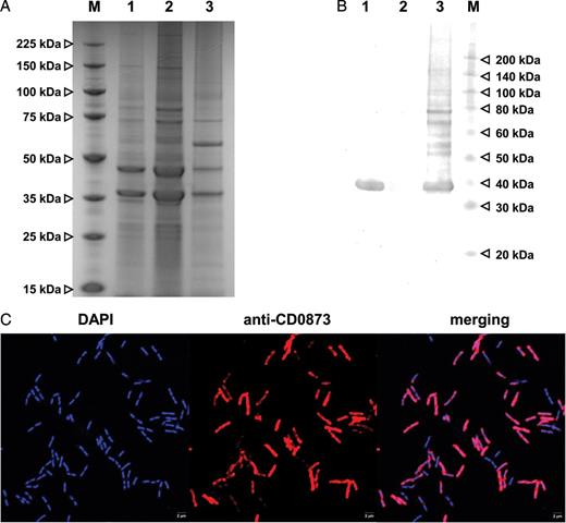 The CD0873 lipoprotein is exposed to the surface of Clostridium difficile. A, Sodium dodecyl sulfate–polyacrylamide gel electrophoresis of the whole-cell lysate and aqueous- and detergent-phase proteins of the wild-type C. difficile 630Δerm cells. B, Western blot analysis of the whole-cell lysate and aqueous- and detergent-phase proteins of the wild-type C. difficile 630Δerm cells, using anti-CD0873 antibodies. The CD0873 lipoprotein was detected in the detergent phase but not in the aqueous phase of the C. difficile 630Δerm cell lysate. Lane M, protein molecular weight marker (in kDa); lane 1, whole-cell lysate; lane 2, aqueous phase; lane 3, detergent phase. C, Immunofluorescence microscopy of the C. difficile 630Δerm strain, using anti-CD0873 antibodies and Fluo568-conjugated anti-rabbit secondary antibodies (red). DNA was stained with DAPI (blue). The CD0873 antibodies were able to bind to whole C. difficile 630Δerm wild-type cells.