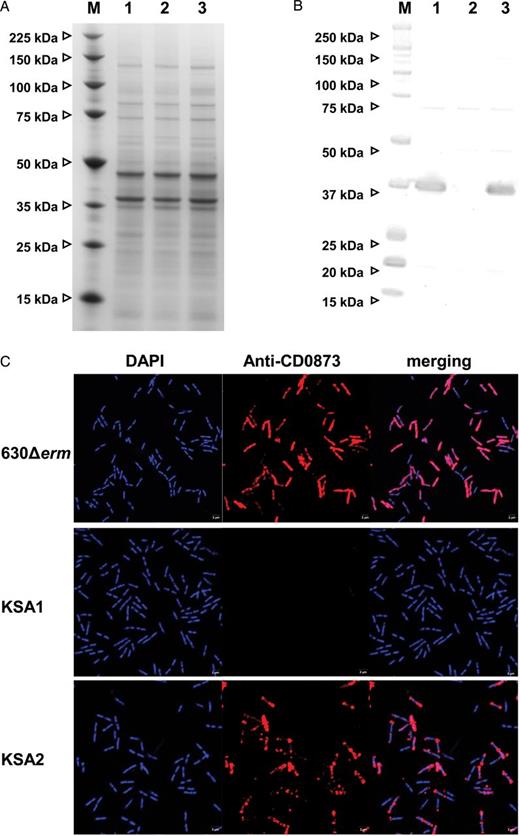 The CD0873 lipoprotein is not expressed in the CD0873 mutant of Clostridium difficile. A, Sodium dodecyl sulfate–polyacrylamide gel electrophoresis of the whole-cell lysates of the 630Δerm, KSA1, and KSA2 strains. B, Western blot analysis of the whole-cell lysates of the 630Δerm, KSA1, and KSA2 strains, using anti-CD0873 antibodies. The CD0873 lipoprotein was detected in 630Δerm and KSA2 but not in KSA1. Lane M, protein molecular weight marker (in kDa); lane 1, 630Δerm; lane 2, KSA1; lane 3, KSA2. C, Immunofluorescence microscopy of the 630Δerm, KSA1, and KSA2 cells, using anti-CD0873 antibodies and Fluo568-conjugated anti-rabbit secondary antibodies (red). DNA was stained with DAPI (blue). The CD0873 antibodies were able to bind to whole C. difficile 630Δerm wild-type and KSA2 cells but not to KSA1 cells.