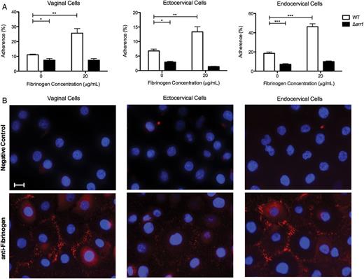 Expression of fibrinogen and its contribution to Srr1-mediated GBS attachment to cervicovaginal epithelia in vitro. A, Adherence of WT NCTC 10/84 or isogenic Δsrr1 to epithelial cells (MOI of 1) with or without the addition of exogenous fibrinogen (20 µg/mL). Data were analyzed by Student t test. *P < .05; **P < .005; ***P < .001. B, Immunofluorescence staining of endogenous fibrinogen (red) on all 3 cell types, and nuclei were visualized with DAPI (blue). (Magnification = 630×, scale bar = 20 µm). Experiments were repeated at least twice with 4 replicates, and data from a representative experiment are shown. Abbreviations: DAPI, 4’,6-diamidino-2-phenylindole; GBS, group B streptococcus; MOI, multiplicity of infection; Srr, serine-rich repeat; srr, serine-rich repeat gene; WT, wild type.