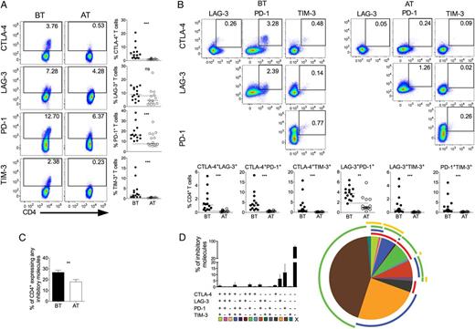 P. vivax infection triggers the expression of regulatory molecules on CD4+ T cells. PBMCs from P. vivax–infected patients were analyzed ex vivo (n = 14). A, Representative density plots showing proportion of CTLA-4, LAG-3, PD-1, and TIM-3 expressing CD4+ T lymphocytes (top to bottom) from a single P. vivax–infected patient BT (left plots) and 30–45 days AT (right plots) (left panel). Percentage of CTLA-4, LAG-3, PD-1, and TIM-3 within CD4+ T lymphocytes in P. vivax–infected patients measured BT (filled circles) and AT (open circles) (top to bottom). Dotted lines represent median values of the given measurements in HD. B, Representative density plots showing frequency of CD4+ T-cells expressing the combination of 2 of the regulatory molecules analyzed (CTLA-4, LAG-3, PD-1, and TIM-3) from a single P. vivax–infected patient BT (left plots) and AT (AT, right plots) (top panels). The proportion of CD4+ T lymphocytes from P. vivax–infected patients BT (filled circles) and AT (open circles) coexpressing any 2 of the regulatory molecules described above (bottom panels). Lines represent median values of the given measurement in each group. **.001 < P < .01 and ***P < .001. Dotted lines represent median values of the given measurements in HD. C, Coexpression of CTLA-4, LAG-3, PD-1, and TIM-3 assessed in T cells from P. vivax–infected patients. Bars indicate mean values and lines represent standard error (left panel). Pie charts represent different grouped populations according to the number of regulatory molecules coexpressed by CD4+ T cells from malaria patients. The combination of gates shows 15 distinct subpopulations. The expression of 4, 3, 2, or 1 regulatory molecule is depicted in different colors and distributed clockwise. Each pie slice represents one of these CD4+ T-cell subpopulations, and red, blue, green, and yellow arcs represent the total proportions of CD4+ T cells expressing CTLA-4, LAG-3, PD-1, and TIM-3, respectively (right panel). Abbreviations: AT, after successful antimalarial treatment; BT, before treatment; CTLA-4, cytotoxic T-lymphocyte attenuator-4; HD, healthy donor; LAG-3, lymphocyte activation gene-3; PBMCs, peripheral blood mononuclear cells; PD-1, programmed death-1; TIM-3, T-cell immunoglobulin and mucin–3.