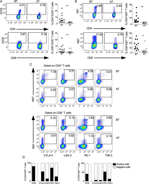 Concurrent expression of Ki-67 and regulatory receptors in T lymphocytes during vivax malaria. Representative density plots (left panel) and scattered plots (right panel) showing proportion of ICOS (A) and Ki-67 (B) expressing CD4+ (upper panel) and CD8+ (lower panel) T lymphocytes from P. vivax–infected patients BT (left panel) and AT (right panel). Flow cytometry plots represent a single patient, and circles indicate individual patients (n = 14). Lines represent median values of the given measurement in each group. **.001 < P < .01 and *** P < .001. Dotted lines represent median values of the given measurements in HD. C, Representative density plots showing proportion of Ki-67+CD4+ (upper panel) and Ki-67+CD8+ (lower panel) T cells expressing CTLA-4, LAG-3, PD-1, or TIM-3 from a single P. vivax–infected patient BT and AT. D, Proportion of cells expressing (filled bars) or not (open bars) ICOS and regulatory molecules within Ki-67+CD4+ (left) and Ki-67+CD8+ (right) T cells (n = 14). Abbreviations: AT, after successful antimalarial treatment; BT, before treatment; CTLA-4, cytotoxic T-lymphocyte attenuator-4; HD, healthy donor; ICOS, inducible costimulator; LAG-3, lymphocyte activation gene-3; PD-1, programmed death-1; TIM-3, T-cell immunoglobulin and mucin–3.
