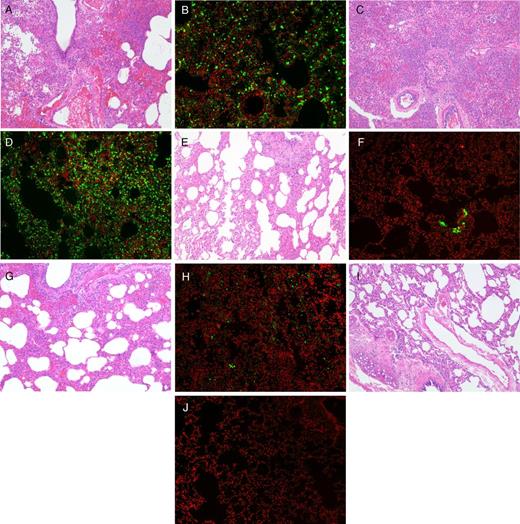 Representative photomicrographs of histopathology examination and immunohistochemical staining of necropsied lung tissues of MERS-CoV-infected common marmosets. Severe acute bronchointerstitial pneumonia centered on terminal bronchioles, with thickened alveolar interstitium and alveoli being filled with large amount of inflammatory cell infiltrate, edema, and hemorrhage in hematoxylin and eosin (H&E)–stained necropsied lung tissue of untreated (A) and MMF-treated (C) animals collected at 36 hpi (magnification, 100×). Abundant expression of MERS-CoV nucleocapsid protein was detected by mouse anti-MERS-CoV nucleocapsid protein (1:200) antibody (green) overlaid with counterstaining by propidium iodide (red) in the necropsied lung tissues of the untreated (B) and MMF-treated (D) animals (magnification, 100×). These pathological changes were seen extensively in multiple lobes of the necropsied lungs of the untreated and MMF-treated animals. Mild acute bronchointerstitial pneumonia with small amount of inflammatory cell infiltrate and preserved histological architecture in H&E-stained necropsied lung tissue of lopinavir/ritonavir-treated (E) animals collected at 72 hpi (magnification, 100×). Mild to moderate acute bronchointerstitial pneumonia with moderate amount of inflammatory cell infiltrate and hemorrhage in H&E-stained necropsied lung tissue of interferon-β1b-treated (G) animals collected at 72 hpi (magnification, 100×). Small amount of MERS-CoV nucleocapsid protein expression was detected in the necropsied lung tissues of the lopinavir/ritonavir-treated (F) and interferon-β1b-treated (H) animals (magnification, 100×). These pathological changes were only seen in lesions which were confined to 1–2 lobes of the necropsied lungs of the lopinavir/ritonavir-treated and interferon-β1b-treated animals. H&E-stained necropsied lung tissue (I) (magnification, 100×) without MERS-CoV nucleocapsid protein expression (J) of an uninfected control animal. Abbreviations: hpi; hours postinoculation; MERS-CoV, Middle East respiratory syndrome coronavirus; MMF, mycophenolate mofetil.