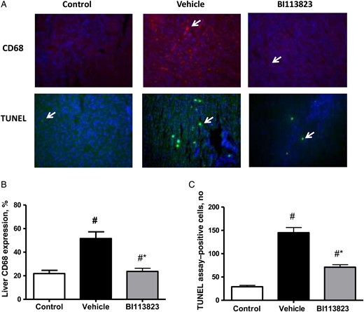 Treatment with BI113823 attenuated iNOS expression and apoptosis at 15 hours following CLP-induced sepsis. A, Representative CD68- and TUNEL-stained liver sections (original magnification, 20×). B, CD68+ macrophages. C, Quantification of TUNEL-positive cells. All values are means ± standard errors of the mean (n = 8). #P < .05 vs the sham control group; *P < .05 vs the vehicle group.