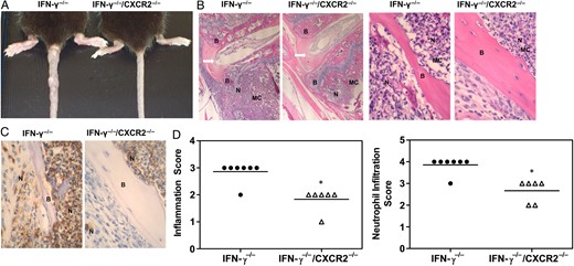 CXCR2 mediates musculoskeletal neutrophil recruitment in Brucella-infected mice. Interferon γ (IFN-γ)−/− and IFN-γ−/−/CXCR2−/− mice were infected intraperitoneally with approximately 1 × 105 colony-forming units of Brucella melitensis 16 M and euthanized 25 days after infection. A, Representative tail images comparing IFN-γ−/− and IFN-γ−/− /CXCR2−/− mice. B, Representative images of hematoxylin-eosin–stained, B. melitensis–infected IFN-γ−/− and IFN-γ−/− /CXCR2−/− tail vertebral sections, using a 4× (left) and 40× (right) objective lens. C, Representative images of sections stained for immunohistochemical analysis with anti-Ly6G, (clone 1A8) indicating neutrophil infiltration, using a 40× objective. D, Histopathological scoring of hematoxylin-eosin staining (for determination of total inflammation) and immunohistochemical analysis (for determination of neutrophil infiltration) of tail vertebra sections (6–7/group). *P < .05 as compared to sections from IFN-γ−/− mice. Abbreviations: Arrow, intervertebral disk; B, bone; MC, medullary cavity; N, neutrophil.