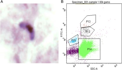 Confirmation of gametocytemia. A, A Giemsa-stained female gametocyte detected on a thick blood smear. B, Gating strategy for gametocyte detection for flow cytometry. Abbreviations: P12/P13, gametocytes; P14, red blood cells; P15, reticulocytes.