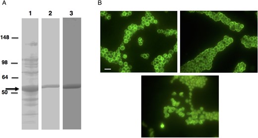 A, Expression of recombinant factor G. Partial complementary DNA sequence encoding the clotting factor G α subunit of Limulus polyphemus was cloned into Pet 28 b vector and was expressed as histidine (His)–tagged fusion protein. Sodium dodecyl sulfate polyacrylamide gel electrophoresis analysis of the bacterial cells expressing recombinant protein showed a band of the expected size (approximately 52 kDa; arrow) when stained with Coomassie Blue (lane 1, crude preparation; lane 2, purified protein), and Western blotting with His-tagged antibody revealed immunoreactivity (lane 3). B, Immunofluorescence microscopy of β-glucan. Methods to detect β-glucan were developed using Saccharomyces cerevisiae. Yeast cells showed immunofluorescence when labeled with biotinylated recombinant factor G and Alexa Fluor 488–conjugated streptavidin (top left), dectin-Fc recombinant protein and Alexa Fluor 488–labeled donkey anti-mouse immunoglobulin G (IgG; top right), or mouse β-1,3-glucan monoclonal antibody and FITC-conjugated goat anti-mouse IgG (bottom). All images are 1000× original magnification. Bar, 10 µm.