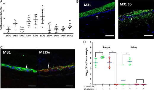 Fungal secreted aspartyl proteases are not required for invasion during coinfection. A, Candida Sap1–10 gene messenger RNA levels were detected in mouse tongue tissues by reverse-transcription quantitative polymerase chain reaction. Results represent fold increase gene expression in coinfected (Candida albicans CAI4-URA3 combined with Streptococcus oralis 34) relative to single C. albicans–infected mice, on day 4 after infection. Means with standard deviations are shown from 5–6 mice in each of the 2 infection groups. B, Overlay images of mucosal tissue analogues infected with C. albicans strain Δsap2456 (M31) alone or in combination with S. oralis 34 (M31So). Tissues were stained with a fluorescein isothiocyanate–conjugated anti-Candida antibody (green) and an Alexa Fluor 568-labeled fluorescence in situ hybridization probe for S. oralis (red) and counterstained with nucleic acid stain Hoechst 33258 (blue), to visualize epithelial layers. Arrows indicate massive mucosal and submucosal invasion of strain M31 in the presence of S. oralis. C, Triple fluorescence staining for E-cadherin (green), calpain 1 (red), and epithelial nuclei (blue) of mucosal analogues infected with C. albicans strain M31 alone or in combination with S. oralis 34 (M31So). Arrows indicate increased calpain 1 and decreased E-cadherin signal in coinfected tissues. Bars represent 50 µm. D, Recovery of C. albicans and S. oralis from tongue and kidneys. Mice were infected with C. albicans strain M31, with or without S. oralis 34, for 4 or 5 days. Tongues and kidneys were homogenized, serially diluted and plated for C. albicans (green) or S. oralis (red) colony-forming unit (CFU) counts. Tongues were collected on day 4 and kidneys on day 5 after infection. Log CFU counts from 5–8 mice per group are shown. Bars indicate means with standard deviations, *P < .05 (comparison between M31 and M31So groups). This figure is available in black and white in print and in color online.