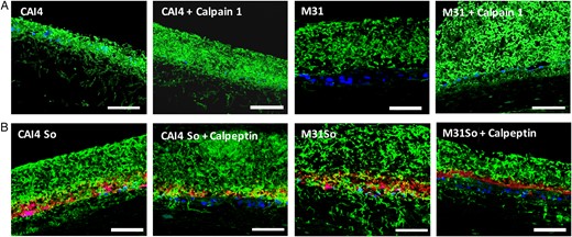 Candida albicans mucosal invasion during coinfection is enhanced by calpain 1 and inhibited by calpeptin. A, Overlay images of mucosal analogue tissue sections stained with anti-Candida antibody (green), counterstained with nucleic acid stain Hoechst 33258 (blue). Tissues were infected with C. albicans strain M31 or reference strain CAI4-URA3 for 16 hours. Recombinant calpain 1 protein was added during infection. Bars represent 50 µm. B, Overlay images of mucosal analogue tissue sections stained with anti-Candida antibody (green) and Alexa Fluor 568–labeled probe for Streptococcus oralis (red) and counterstained with nucleic acid stain Hoechst 33258 (blue). Tissues were infected with C. albicans strain M31 or reference strain CAI4-URA3, with or without S. oralis 34 (So). Tissues were pretreated overnight with calpeptin, a calpain-selective inhibitor. Bars represent 50 µm. This figure is available in black and white in print and in color online.