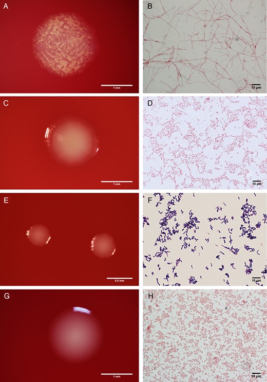 Colony morphology (left) and Gram stains (right) of vaginal bacteria. Representative isolates from the 4 groups described in the study are shown, including Lachnospiraceae bacterium DNF00160 (A, B), Prevotella massiliensis DNF00663 (C, D), Corynebacterium kroppenstedtii DNF00591 (E, F), and Peptoniphilus lacrimalis DNF00528 (G, H).