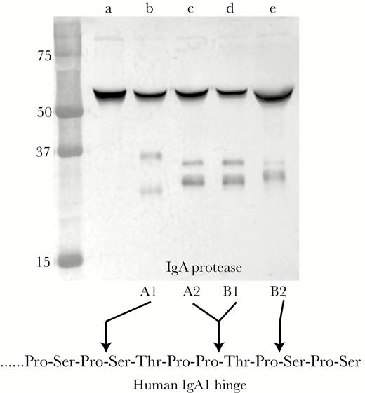 Immunoblot assay showing cleavage pattern of purified human immunoglobulin (Ig)A incubated with epithelial cell culture supernatant collected 3 hours after inoculation of cell cultures with bacterial strains. Lanes (a) strain 29P30H1, which expresses no IgA protease; (b) strain 19P49H1, which expresses IgA protease A1; (c) strain 84P12H1, which expresses IgA protease A2; (d) strain 33P46H1, which expresses IgA protease B1; (e) 56P34H4, which expresses IgA protease B2. The cleavage specificity of the human IgA1 hinge region is shown at the bottom. Molecular mass markers are noted in kilodaltons on the left.