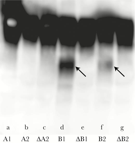 Lysosomal-associated membrane protein 1 (LAMP1) cleavage assay. Aliquots of cell culture medium from H292 cells infected for 24 hours with wild-type and mutant strains as indicated were filter sterilized and incubated with recombinant human LAMP1 at 37°C overnight. Digestions were separated on protein gels, transferred to polyvinylidene difluoride membrane, probed with antihuman LAMP1 antibody, and visualized by chemiluminescence. The large top band is intact LAMP1, and the smaller bands at the arrows are LAMP1 cleavage fragments. The IgA protease expressed by each strain is noted at the bottom; knockout mutants are noted by Δ. Lanes contain nontypeable Haemophilus influenzae strains: (a) 105P29H1, (b) 124P34H1, (c) igaA2 knockout mutant of 124P34H1, (d) 11P6H, (e) igaB1 knockout mutant of 11P6H, (f) 2019, (g) igaB2 knockout mutant of 2019.