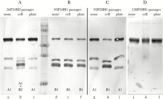 Immunoblot assays showing effect of passage of strains through human bronchial respiratory epithelial cells. (A) Immunoglobulin (Ig)A protease expression of strain 56P34H2 upon original isolation from sputum (lane a), after passaging through epithelial cells (lane b), and after passage on agar plates (lane c, control). (B) The IgA protease expression of strain 93P10H1 upon original isolation from sputum (lane d), after passage through epithelial cells (lane e), and after passage on agar plates (lane f, control). (C) The IgA protease expression of strain 93P28H1, which is the same strain as 93P10H1 that persisted in the respiratory tract for 543 days, upon original isolation from sputum (lane g), after passage through epithelial cells (lane h), and after passage on agar plates (lane I, control). (D) IgA protease expression of strain 138P39H1 upon original isolation from sputum (lane j), after passage through epithelial cells (lane k), and after passage on agar plates (lane l, control). A, B, and C are the same immunoblot. IgA protease expression is noted at the bottom of each lane. Molecular mass markers are noted in kilodaltons.