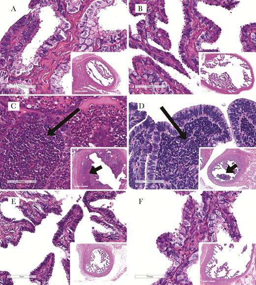 Representative fallopian tube histological staining with hematoxylin and eosin for uninfected animals, animals with pelvic inflammatory disease (PID), and animals with lower reproductive tract infection, by levonorgestrel (LNG)–releasing intrauterine system (LNG-IUS) receipt. PID, when present, was manifested as leukocyte infiltration to the tubal propria (salpingitis). A and B, Uninfected animals without (A) and with (B) the LNG-IUS, showing high magnification of thin tubal propria lined by epithelium (inset shows the low-magnification overview). C and D, Infected animals positive for PID, showing infiltrating leukocytes (long arrows) in animals without (C) and with (D) an LNG-IUS. Leukocyte infiltration is seen as proprial thickening (short arrows) at low magnification (insets) in both animals. E and F, Infected animals with infection confined to the lower reproductive tract, showing normal thin propria (similar to uninfected controls) in animals without (E) and with (F) an LNG-IUS. See the text for a description of leukocytic infiltrations. Scale bars denote 70 um (panels) and 700 um (insets).