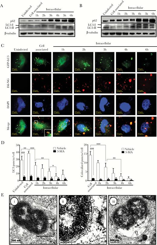 The autophagy pathway is activated and targets Neisseria gonorrhoeae during cell invasion. (A) Western analysis of the autophagy marker proteins p62 and LC3 during N. gonorrhoeae invasion of HeLa cells in gentamycin protection assays. Representative images are shown of at least 3 independent biological repeats. β-tubulin was included as loading control. (B) Western analysis of p62 and LC3 in gentamycin protection assays after pretreatment with the V-ATPase inhibitor bafilomycin A1 (BafA1). Representative images are shown of at least 3 independent biological repeats. (C) Confocal microscopy analysis of GFP-LC3 puncta and colocalization with Dil-stained N. gonorrhoeae in gentamycin protection assays. The HeLa cell nucleus was stained with 4’,6-diamidino-2-phenylindole (DAPI). (D) Quantification of total LC3 puncta and colocalization of LC3 puncta with N. gonorrhoeae from panel C and 3-MA pretreated control cells. The graphs represent the mean and standard deviation of 3 independent experiments, and at least 100 cells were analyzed for each repeat. Significant differences between time points and between treatment and control were identified by Student’s t test. *, P < .05; **, P < .01; ***, P < .005. (E) Transmission electron microscopy analysis of intracellular N. gonorrhoeae after 1 hour of invasion in HeLa cells. (i) N. gonorrhoeae-containing autophagosome. Arrows in image (ii) indicate the vacuolar and double autophagic membrane surrounding N. gonorrhoeae, which is the hallmark of autophagosomes. The arrow in image (iii) indicates additional autophagic structures that appear to fuse with the N. gonorrhoeae-containing autophagosome.