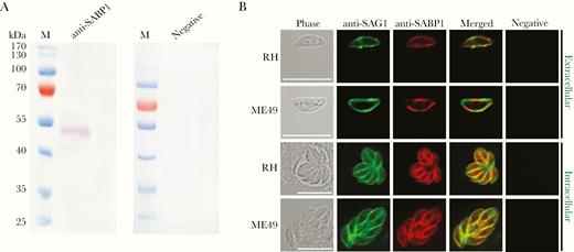 Toxoplasma gondii sialic acid binding protein-1 (TgSABP1) expressed in T. gondii is localized on the outer membrane of tachyzoites. A, Western blot analysis of native SABP1 expression in T. gondii detected by SABP1-specific antibodies. Sera of a healthy rat was used as the negative control. B, The localization of TgSABP1 (red) overlapped with surface antigen-1 (SAG1, green) was detected on the surface of both intracellular and extracellular parasites (without permeabilization) of T. gondii (RH and ME49 strains). Sera of a healthy rat was used as the negative control. Scale bar, 10 μm.