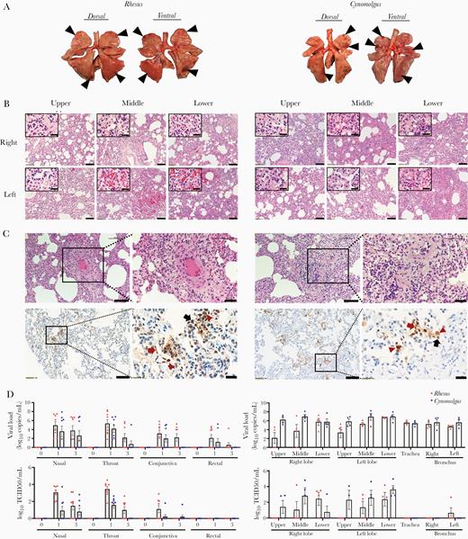 Pathological changes in macaques infected with SARS-CoV-2. Four rhesus and 4 cynomolgus macaques were euthanized at 3 dpi. A, Focal areas (black arrow head) of pulmonary consolidation in the lung lobes of macaques at 3 dpi. B, Histological analysis was performed on lobes (upper/middle/lower) of right and left lung in macaques. Scale bar, 100 μm; inset, 20 μm. C, There was apparent endothelial cell necrosis, as well as PMN and mononuclear leukocyte infiltration, in the intima of small and medium arterial vessels (H&E staining). Edema of the blood vessel walls and PMN and mononuclear cell infiltration around the blood vessels can be seen. Scale bar, 100 and 50 μm in the left and right panels of each macaque species, respectively. Immunohistochemistry showed detection of SARS-CoV-2 antigen in the lungs. Scale bar, 100 μm and 20 μm. Type I pneumocytes (red arrow), type II pneumocytes (black arrow), and alveolar macrophage (red arrowhead). D, Swab samples and tissues were collected at 3 dpi and quantified for viral RNA (copies/mL) using qRT-PCR and TCID50/mL. Mean± sem. Abbreviations: SARS-CoV-2, severe acute respiratory syndrome coronavirus-2; dpi, days post infection; PMN, polymorphonuclear; qRT-PCR, quantitative reverse transcription polymerase chain reaction; TCID50, median tissue culture infectious dose.