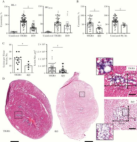 Pneumolysin is required for Streptococcus pneumoniae cardiac damage. A, Cytotoxicity as assessed by the amount of lactate dehydrogenase released into the supernatant by HL-1 mouse cardiomyocytes (black bars) and human cardiomyocytes immortalized with SV40 T-antigen (HCSV40) (white bars) infected with S. pneumoniae strains TIGR4 or D39 or mock-infected (uninfected) after 4 hours at a multiplicity of infection (MOI) of 100. B, Cytotoxicity of HCSV40 infected with TIGR4 or TIGR4 Δply and in the presence of neutralizing monoclonal antibody against pneumolysin (Ply Ab) after 4 hours (MOI, 100). C, Number and size of cardiac microlesions in heart sections from mice infected with TIGR4 or Δply, quantified from hematoxylin-eosin (HE)–stained cardiac sections. D, Representative HE-stained images and number of lesions in heart sections from mice infected intraperitoneally with TIGR4 or Δply. Hearts from infected mice were collected 30 hours after intraperitoneal challenge. Sections were tile scan imaged at ×40 magnification, with the cardiac apex positioned at the bottom of figure; scale bars represent as 500 μm in tile scans and100 μm in lesion panel with 110-μm2 highlighted lesion section. *P ≤ .05; †P ≤ .01; ‡P ≤ .001. (See also Supplementary Figure 1.)