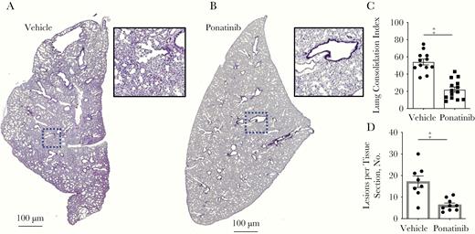 Therapeutic Ponatinib treatment reduces lung and cardiac damage from pneumococcal pneumonia and invasive pneumococcal disease. A, B, Representative hematoxylin-eosin (HE)–stained lung sections from C57Bl/6 mice (n = 12–14) infected intratracheally with TIGR4 and treated intraperitoneally with vehicle (2% dimethyl sulfoxide in phosphate-buffered saline; 0 mg/kg) (A) or ponatinib at 1 mg/kg every 12 hours (B) and euthanized 48 hours after infection. C, HE-stained lung sections were quantified for detectable biomass as an indication of lung consolidation, using ImageJ software. D, Cardiac microlesions per tissue section from these same mice. Mann-Whitney U tests were used for 2-group comparisons. ‡P ≤ .001. (See also Supplementary Figure 5.)