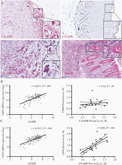 Immunohistochemical analysis of coxsackievirus and adenovirus receptor (CXADR) expression and localization in human carotid plaques. A, Sections of a carotid artery containing a plaque (upper and lower left), a normal artery (upper right), and the appendix (lower right) were stained with antibodies against CXADR (upper panels), or the combination of CXADR and CD68 (lower panels). B, C, Pearson correlation analysis showing the association between CXADR and CD68 (B) and between CXADR and CD36 (C) in human carotid plaques at messenger RNA (left) and protein (right) levels. Abbreviation: AU, arbitrary units.
