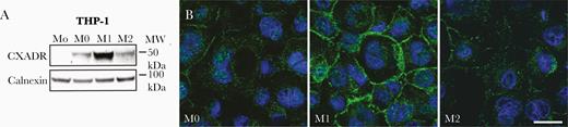 Induction of coxsackievirus and adenovirus receptor (CXADR) during monocyte-to-macrophage differentiation. A, Western blot analysis showing CXADR protein levels in THP-1 cells cultured as monocytes (Mo), differentiated into macrophages (M0), and further polarized into M1 or M2 macrophages. Abbreviation: MW, molecular weight. B, Immunofluorescence staining for CXADR (green) in THP-1 cells differentiated into M0, M1, or M2 macrophages. Cell nuclei were counterstained with DAPI (blue). Images were obtained with a Zeiss LSM700 confocal microscope and processed with NIS-Elements software (version 4.0). (https://www.microscope.healthcare.nikon.com/products/software/nis-elements). (Scale bar represents 10 μm.)