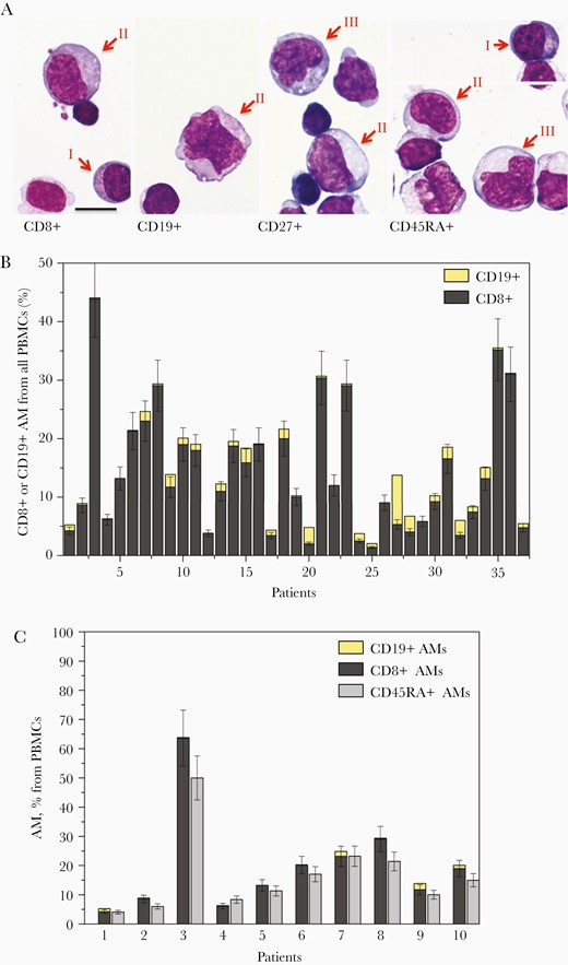 Morphology and percentage of CD8+ and CD19+ AM in peripheral blood of patients with primary EBV-infection on the anti-CD microarray. A, AM from patients with primary EBV-infection–associated infectious mononucleosis captured on the microarray by anti-CD8, anti-CD19, anti-CD27, and anti-CD45RA stained after May-Grünwald-Giemsa. AM are indicated by arrows, Roman numbers indicate the Downey cell types I, II, and III. The bar corresponds to 10 μm. B, The percentages of AM CD19+ and CD8+ among PBMCs of 37 patients with primary EBV infection determined as the density of AM captured by anti-CD8 or anti-CD19 normalized to the density of anti-CD45RA–bound PBMCs. C, The percentages of CD8+ and CD19+ AM among PBMCs and their sum compared to total percentage of AM from all PBMCs for the first 10 patients in (B) with primary EBV-infection. Abbreviations: AM, atypical mononuclear cell; EBV, Epstein-Barr virus; PBMC, peripheral blood mononuclear cell.