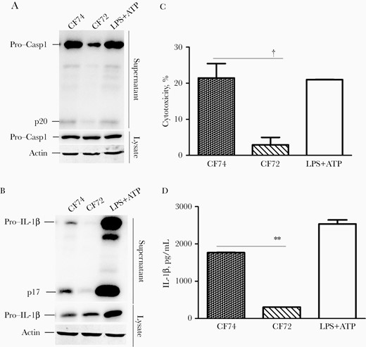 CF74 activates the inflammasomes. Macrophages from the indicated C57BL/6 mice were infected with Citrobacter freundii CF74 or CF72 for 4 hours at a multiplicity of infection of 10. A, B, Caspase 1 activation and interleukin 1β (IL-1β) secretion in the bone marrow–derived macrophages infected with C. freundii were analyzed by immunoblotting. Abbreviations: ATP, adenosine triphosphate; LPS, lipopolysaccharide; lysate, whole-cell lysates; p17, IL-1β secretion; p20, activated caspase 1; Pro-Casp1, pro–caspase 1. C, D, Quantification of lactate dehydrogenase release (C) and IL-1β secretion (D); error bars represent standard deviations from ≥3 determinations. †P < .01 (analysis of variance). LPS + ATP served as the positive control.