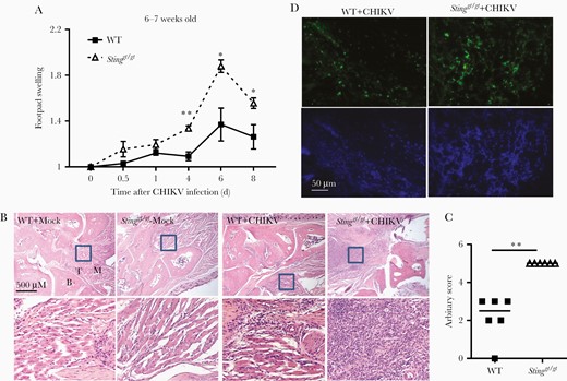 Exacerbated joint inflammation in Stinggt/gt mice. A, Fold changes in the footpad dimensions of infected (at days 0.5, 1, 4, 6, and 8 post infection) over the uninfected (day 0). Bars indicate mean + SEM. B, Representative micrographs of staining H&E from mock- and CHIKV-infected joints at day 8 post infection (× 40). The boxed areas indicate the regions with severe immune cell infiltration and tissue damage (× 200). C, Arbitrary H&E scores for the CHIKV-infected footpads/ankle joints at day 8 post infection using a scale of 1 to 5, with 5 representing the worst disease presentation. Each symbol represents 1 mouse; short horizontal line indicates the median. n = 6/genotype. *, P < .05; **, P < .01 (2-tailed unpaired Student t test). The data represent 2 independent experiments. D, Confocal microscopic images of immunofluorescence staining for a pan-immune cell marker CD45 (× 200). Abbreviations: B, bone; CHIKV, chikungunya virus; H&E, hematoxylin and eosin; M, muscle; STING, stimulator of interferon gene; T, tendon; WT, wild type.