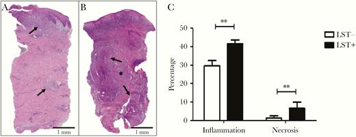 Areas of inflammation and necrosis in biopsies from Leishmania skin test (LST)-negative and LST-positive patients. Histological sections of (A) LST-negative and (B) LST-positive biopsies (hematoxylin and eosin, × 40). Area of inflammation (arrows/purple) and area of necrosis (*) are indicated. C, Percentage of area of inflammation and necrosis in biopsies from LST-negative and LST-positive patients. Statistical analysis was performed using unpaired Student t test; n = 25; ** P < .001. Bars represent mean and standard error.