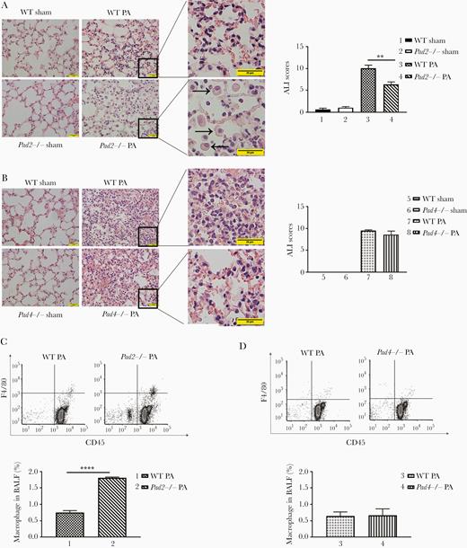 Pad2 deficiency ameliorates acute lung injury (ALI) in a mouse model of Pseudomonas aeruginosa (PA)-induced sepsis. Mice were intranasally inoculated with PA (2.5 × 106 colony-forming units per mouse). (A, left) Representative images show hematoxylin and eosin-stained lung sections of wild-type (WT) and Pad2−/− mice at 24 hours after PA inoculation; (right) ALI scores were quantified for the groups shown at left (scale bar, 20 μm; black arrows were pointed to macrophages); (B, left) Representative images show hematoxylin and eosin-stained lung sections of WT and Pad4−/− mice at 24 hours after PA inoculation; (right) ALI scores were quantified for the groups shown at left (scale bar, 20 μm); (C, top) Flow cytometry show macrophage numbers in alveoli of WT mice, Pad2−/− mice, and Pad4−/− mice at 24 hours after PA inoculation; (bottom) quantification of flow cytometry data were performed. All experiments were conducted at least 3 independent times with 4 replicates. Data in A and B were analyzed by one-way analysis of variance followed by Tukey’s multiple comparison tests. Data in C were analyzed by unpaired Student t tests. All the data are presented as mean ± standard error of mean. **, P < .01; ****, P < .0001. BALF, bronchoalveolar lavage fluid; Pad, peptidylarginine deiminase.