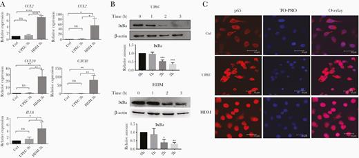 UPEC infection induces NFκB activation but does not result in proinflammatory cytokine/chemokine expression. A, Human bladder carcinoma 5637 cells were incubated with UPEC, HDM, or medium alone (Ctrl) for 3 hours. mRNA expression of indicated genes was quantified by RT-qPCR. Shown are the means ± SD of 3 independent experiments. Data were analyzed by 1-way ANOVA with multiple comparisons test. B, 5637 cells were infected with UPEC or HDM for indicated time points, and then analyzed for the presence of IκBα and β-actin proteins by immunoblotting. Representative images of 3 independent experiments are shown. Relative amounts of IκBα were quantified as described in “Methods.” Data were analyzed by 1-way ANOVA with multiple comparisons test (means ± SD of 3 independent experiments). C, Immunofluorescence labelling of NFκB p65 in 5637 cells incubated for 3 hours with UPEC, HDM, or medium alone (Ctrl). Nuclei were stained with TO-PRO nuclear dye. Representative images of each sample are shown. Experiments were repeated 3 times. Scale bar = 30 µm. *P < .05, **P < .01, ***P < .001, ****P < .0001. Abbreviations: ANOVA, analysis of variance; Ctrl, control; HDM, α-hemolysin double mutant; TO-PRO, TO-PRO™-3 Iodide; IκBα, inhibitor of κBα; NFκB, nuclear factor-κB; ns, nonsignificant; RT-qPCR, quantitative reverse transcription polymerase chain reaction; UPEC, uropathogenic Escherichia coli.