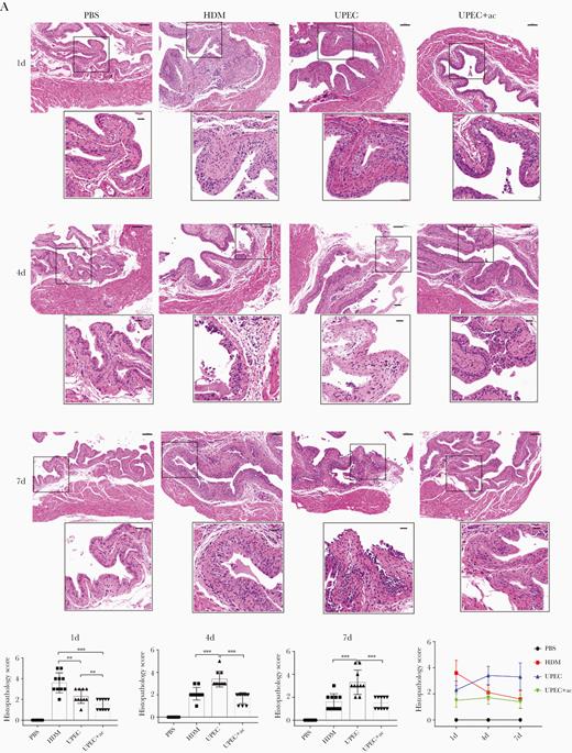 Acetate treatment ameliorates UPCE-elicited cystitis. A, Representative images of hematoxylin and eosin-stained bladder sections from mice treated with PBS, HDM, UPEC, or UPEC plus acetate at the indicated timepoints are shown. Scale bars = 100 µm (upper) and 25 µm (lower). B, Histopathology scores were assessed; n = 6–10/group of 3 independent experiments were conducted. Data points represent values for each individual mouse, bars indicate median values. Data were analyzed by 1-way ANOVA with multiple comparisons test. **P < .01, ***P < .001. Abbreviations: ac, acetate; ANOVA, analysis of variance; HDM, α-hemolysin double mutant; PBS, phosphate-buffered saline; UPCE, uropathogenic Escherichia coli.