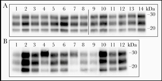 Immunoblot of porcine protease-resistant prion protein (PrPres). A, Brain PrPres Western blot profile in porcine PrP (PoPrP)–Tg001 mice inoculated with the different classic bovine spongiform encephalopathy (BSE)–derived inocula: Ca-BSE 2 (lane 1), Ca-BSE 2/Tg110 Bo6OR (lane 2), Ca-BSE 2/Tg008 Bo5OR (lane 3), BSE in sheep ARQ/ARQ (lane 4), BSE in sheep ARR/ARR (lane 5), BSE in TgOV ARQ (lane 6), BSE in TgOV ARR (lane 7), experimental BSE in goat (lane 8), BSE in goat CH636 (lane 9), BSE in Tga20 (lane 10), BSE in wild-type mouse (lane 11), variant Creutzfeldt-Jakob disease (vCJD) 129 M/M NHBY0/0014 (lane 12), vCJD 129 M/M BC1458 (lane 13), and BSE in HuPrP-Tg340 (lane 14). B, Brain PrPres Western blot profile in the different inocula and in the PoPrP-Tg001 brain homogenates after in vivo or in vitro experiments. Original inocula used included Ca-BSE/Pig (lane 1), Ca-BSE 2 (lane 4), BSE in Sheep ARQ/ARQ (lane 7), and vCJD 129 M/M BC1458 (lane 10). PoPrP-Tg001 mouse infected with: Ca-BSE/Pig (lane 2), Ca-BSE 2 (lane 5), BSE in Sheep ARQ/ARQ (lane 8) and vCJD 129 M/M BC1458 (lane 11). Brain homogenates from PoPrP-Tg001 were used in protein misfolding cyclic amplification seeded with Ca-BSE/Pig (lane 3), Ca-BSE 2 (lane 6), BSE in sheep ARQ/ARQ (lane 9), and vCJD 129 M/M BC1458 (lane 12). PrPres was detected using Sha31 monoclonal antibody. (Molecular weight in kilodaltons is shown at the right of each panel.)