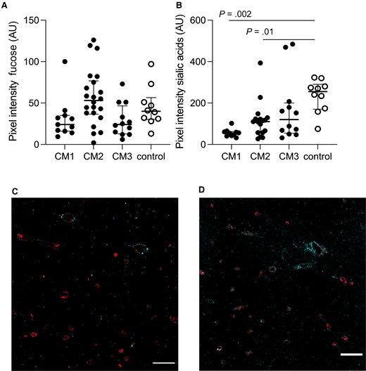 Fucose levels are unchanged and sialic acid residues are reduced in patients with cerebral malaria (CM). A, Fucose residues were present to the same extent in all groups (P > .34). B, Sialic acids were notably reduced in CM1 and CM2 patients (P = .002 and P = .01). C, Representative image shows levels of sialic acid residues in cyan in CM1 patients overlaid with CD34 in red. D, Representative image shows levels of sialic acid residues in cyan in the control group overlaid with CD34 in red. Scale bars = 100 μm. Images represent the median values in the groups. In A and B, each dot represents a subject. The median value is marked with a line, and bars show the interquartile ranges.