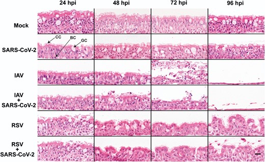 Morphological changes in air-liquid interface cultures of human bronchial cells infected with severe acute respiratory syndrome coronavirus 2 (SARS-CoV-2), influenza A virus (IAV), and respiratory syncytial virus (RSV) in single and coinfections. Representative images of histological sections of cultures infected at different hours postinfection (hpi) with the indicated viruses and stained with hematoxylin and eosin. Images are representative of a minimum of 2 independent experiments. Arrows indicate ciliated cells (CC), basal cells (BC), and goblet cells (GC). Scale bar represents 20 μm.