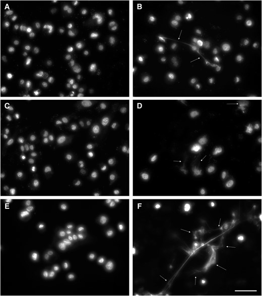 Degradation of extracellular traps produced by THP-1 cells. THP-1 cells were stimulated to produce extracellular traps and then incubated with Mycoplasma penetrans isolates as described in “Methods” and imaged using SYTOX green DNA stain. Strains U2, U4, U5, and U7 (A, B, C, and D, respectively) all showed the ability to clear the DNA released by the THP-1 cells, though strains U4 and U7 infrequently left some intact. Unstimulated (E) and stimulated (F) THP-1 cells are shown as controls. White arrows, extracellular traps; scale bar, 50 μm.