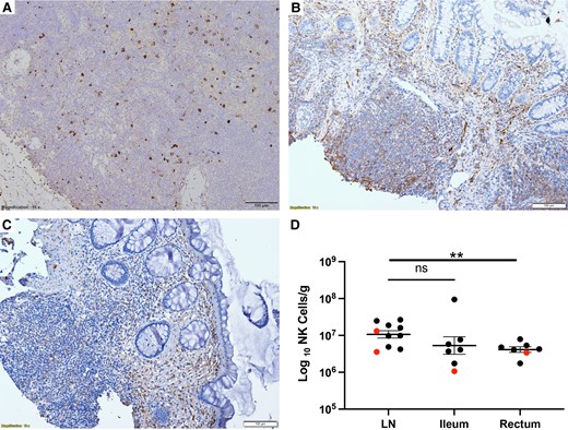 The frequency of CD56+ NK cells in LN, ileum, and rectum obtained one week after the last cytokine infusion. LN (A), ileum (B), and rectum (C) obtained one week after the last cytokine infusion stained with antibodies against CD56 to mark NK cells. Because there was no difference in the baseline and postinfusion frequency of CD56+ cells at each tissue site, we pooled baseline and postinfusion data to compare frequency of cells in each tissue site (D). Results from those receiving IL-2 are marked in red and those receiving N-803 in black. There was no difference between LN and ileum but the frequency in rectum was significantly lower (**P = .01, unpaired t test). Lines represent mean and standard error of the mean. Abbreviations: LN, lymph node; NK cell, natural killer cell; ns, not significant.