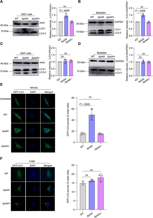 PldA contributes to UPEC escape from autolysosomes by affecting autophagy. A, Western blotting of LC3-II levels in WT, ΔpldA, or ΔpldA+ infected 5637 cells at 4 hpi. Actin was used as a loading control. B, Western blotting of LC3-II levels in WT, ΔpldA, or ΔpldA+ infected mouse bladders at 6 hpi. GAPDH was used as a loading control. C, Western blotting of LC3-II in WT, ΔpldA, or ΔpldA+ infected 5637 cells treated with 3-MA. The LC3-II signal densities were normalized to that of actin. D, Western blotting of LC3-II in WT, ΔpldA, or ΔpldA+ infected mouse bladders treated with 3-MA. The LC3-II signal densities were normalized to that of GAPDH. E, 5637 cells were transfected with GFP-LC3 for 24 hours and infected with the indicated CFT073 strains or left uninfected. The cells were analyzed for GFP-LC3 puncta. Representative confocal images are shown. The bar graph shows the quantification of LC3 puncta per cell. Scale bar, 5 μm. n = 3 slides. F, 5637 cells were transfected with GFP-LC3 for 24 hours, followed by treatment with 3-MA and infection with the indicated CFT073 strains. The cells treated with 3-MA were analyzed for GFP-LC3 puncta. Representative confocal images are shown. The bar graph shows the quantification of LC3 puncta per cell. Scale bar, 5 μm. n = 3 slides. Data are representative of 3 independent experiments and presented as the mean ± SD. The bar graph shows the relative LC3-II/actin (A and C) and LC3-II/GAPDH (B and D) densities. Data are presented as the mean ± SD. P values were determined using Student t test. Significance is indicated by the P value. Abbreviations: 3-MA, 3-methyladenine; DAPI, 4′,6-diamidino-2-phenylindole; GAPDH, glyceraldehyde-3-phosphate dehydrogenase; GFP, green fluorescent protein; hpi, hours postinfection; ns, not significant; UPEC, uropathogenic Escherichia coli; WT, wild type.