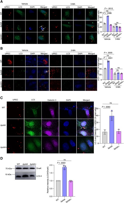 PldA is sufficient for autophagy evasion by UPEC in the cytosol. A, Immunofluorescence staining showing the colocalization of the autophagosome marker LC3 with the indicated strains expressing mCherry at 4 hours in 5637 cells pretreated with vehicle or 2.5 mM 3-MA for 12 hours. Representative confocal images are shown, and the arrow indicates LC3+ bacteria. The bar graph shows the percentage of intracellular bacteria that colocalized with LC3 relative to the total number of cells. Scale bar, 5 μm. n = 3 slides. B, Colocalization of LC3 with UPEC at 6 hpi in mouse bladders pretreated with vehicle or 35 mM 3-MA. Representative images are shown, and the arrow indicates LC3+ bacteria. The bar graph depicts the percentage of bacteria colocalizing with LC3 relative to the total number of cells. Scale bar, 5 μm. n = 3 slides. C, Colocalization of LC3 and galectin-3 with UPEC in 5637 cells at 4 hpi. Representative images are shown, and the arrow indicates LC3 and galectin-3+ bacteria. The bar graph depicts the percentage of bacteria colocalizing with LC3 and galectin-3 relative to the total number of cells. Scale bar, 5 μm. n = 3 slides. D, Western blotting of LC3-II in the vesicles containing bacteria from WT, ΔpldA, or ΔpldA+ infected 5637 cells. The LC3-II signal densities were normalized to that of bacteria DnaK. Data are presented as the mean ± SD. P values were determined using Student t test. Significance is indicated by the P value. Abbreviations: 3-MA, 3-methyladenine; DAPI, 4′,6-diamidino-2-phenylindole; hpi, hours postinfection; ns, not significant; UPEC, uropathogenic Escherichia coli; WT, wild type.