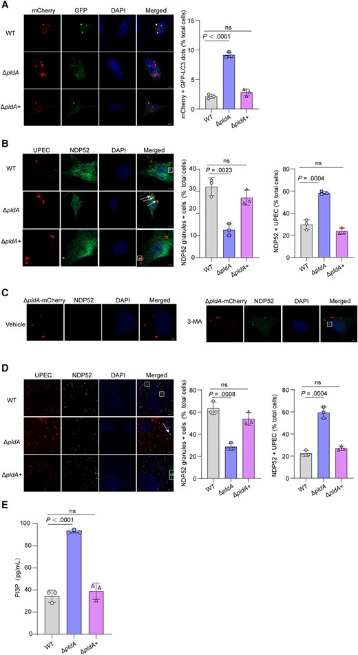 PldA induces the accumulation of NDP52 granules. A, Representative images of 5637 cells transfected with mCherry-GFP-LC3 for 24 hours and infected with WT, ΔpldA or ΔpldA+ for 4 hours. Autophagosomes, yellow puncta; autolysosomes, red puncta. The bar graph shows the quantification of LC3 red puncta per cell. Scale bar, 5 μm. n = 3 slides. B, Colocalization of NDP52 with CFT073 expressing mCherry in 5637 cells at 4 hpi. The arrows indicate NDP52+ bacteria, and the square frames indicates NDP52 granules (left). The bar graph shows the percentage of cells infected with the indicated strains displaying 1 or several NDP52 granules (middle) and the intracellular bacteria that colocalized with NDP52 relative to the total number of cells (right). Scale bar, 5 μm. n = 3 slides. C, NDP52 granules of ΔpldA-mCherry–infected 5637 cells treated with either vehicle or 2.5 mM 3-MA. The square frame indicates an NDP52 granule. Scale bar, 5 μm. n = 3 slides. D, Colocalization of NDP52 with CFT073 expressing mCherry in mouse bladders at 6 hpi. The arrow indicates NDP52+ bacteria, and the square frame indicates NDP52 granules (left). The bar graph shows the percentage of cells infected with the indicated strains displaying 1 or several NDP52 granules (middle) and the intracellular bacteria that colocalized with NDP52 relative to the total number of cells (right). Scale bar, 5 μm. n = 3 slides. E, 5637 cells infected with WT, ΔpldA, or ΔpldA+ for 4 hours were lysed and PI3P levels were measured by competitive ELISA. Data are presented as the mean ± SD. P values were determined using Student t test. Significance is indicated by the P value. Abbreviations: 3-MA, 3-methyladenine; DAPI, 4′,6-diamidino-2-phenylindole; ELISA, enzyme-linked immunosorbent assay; hpi, hours postinfection; ns, not significant; PI3P, phosphatidylinositol 3-phosphate; RFP-GFP, red fluorescent protein-green fluorescent protein; WT, wild type.