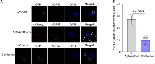 Inhibition of preautophagosomal maturation by UPEC PldA protects against autophagy in host cells. A, Colocalization of NDP52 with the WT strain expressing GFP, ΔpldA expressing mCherry, or both strains at a 1:1 ratio in 5637 cells at 4 hpi. The arrow indicates NDP52+ bacteria, and the square frame indicates NDP52 granules. Scale bar, 5 μm. B, Quantification of the intracellular bacteria that colocalized with NDP52 relative to the total number of cells infected with either ΔpldA-mCherry alone or WT-GFP and ΔpldA-mCherry (coinfection). n = 3 slides. Data are presented as the mean ± SD. P values were determined using Student t test. Significance is indicated by the P value. Abbreviations: DAPI, 4′,6-diamidino-2-phenylindole; GFP, green fluorescent protein; hpi, hours postinfection; ns, not significant; UPEC, uropathogenic Escherichia coli; WT, wild type.