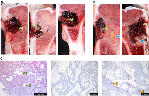 Pathological and histopathological investigations after CarboCell-formulated antibiotic treatment of the implant-associated osteomyelitis porcine model. A, Macropathological photographic examples of cross-sectioned pig tibiae from CC3-clindamycin (left), CC3-clindamycin + DSF (center), and CC2-clindamycin (right). B, Photographic examples of pigs presenting with sequestrate; CC3-clindamycin (left) and CC3-clindamycin + DSF (right). C, Left, an hematoxylin and eosin-stained histological section of the pathological bone area showing CarboCell depots at microscopic levels; center, an example of a Staphylococcus aureus-negative IHC staining of bone; and right, an example of a S. aureus-positive IHC staining of bone. Green arrows point to macroscopic and microscopic examples of CarboCell depots. Blue arrows point to sequestrae. Yellow arrows point to S. aureus aggregates. Release data of antimicrobials in each treatment group are shown in Supplementary Table 8. Quantified bacterial burden in logCFU/g at time of debridement and administration of antibiotic-formulated CarboCell, and the bacterial burden postmortem can be found in Supplementary Figure 5. Abbreviations: CC, CarboCell; CFU, colony-forming unit; DSF, diffusible signal factor, cis-11-methyl-2-dodecenoic acid; IHC, immunohistochemistry.